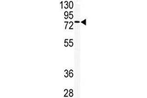 Western blot analysis of TLK2 antibody and mouse testis tissue lysate. (TLK2 antibody  (AA 141-171))