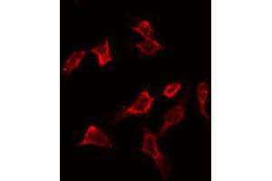 ABIN6266904 staining HeLa by IF/ICC. (PFKFB1/4 antibody)