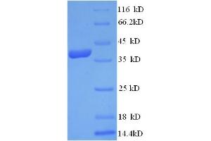 SDS-PAGE (SDS) image for Dermcidin (DCD) (AA 20-110) protein (GST tag) (ABIN4976039) (Dermcidin Protein (DCD) (AA 20-110) (GST tag))