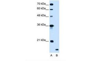 Image no. 1 for anti-Ring Finger Protein 175 (RNF175) (AA 58-107) antibody (ABIN341280) (RNF175 antibody  (AA 58-107))