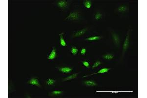 Immunofluorescence of purified MaxPab antibody to SIK1 on HeLa cell. (SIK1 antibody  (AA 1-783))