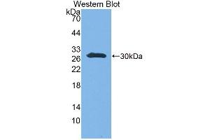 Western Blot; Sample: Recombinant protein. (UBE2S antibody  (AA 1-209))