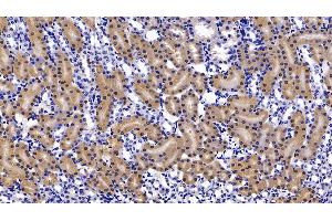 Detection of FABP1 in Mouse Kidney Tissue using Polyclonal Antibody to Fatty Acid Binding Protein 1 (FABP1)