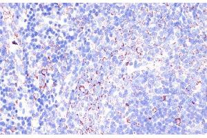 Immunohistochemistry of paraffin-embedded Rat spleen using CD18 Polyclonal Antibody at dilution of 1:100 (40x lens). (Integrin beta 2 antibody)