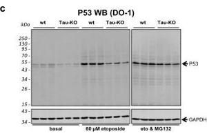 Role of P53 and MDM2 modifications for P53 function and stability. (p53 antibody  (AA 1-393))