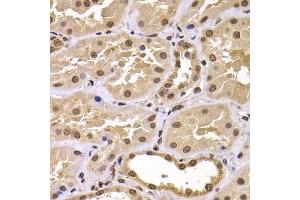 Immunohistochemistry of paraffin-embedded human kidney using CSRP2BP antibody (ABIN5975516) at dilution of 1/100 (40x lens). (CSRP2BP antibody)