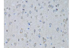 Immunohistochemistry of paraffin-embedded rat brain using GABARAP antibody (ABIN5973270) at dilution of 1/100 (40x lens).