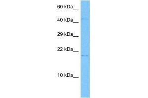 Host:  Mouse  Target Name:  GADD45B  Sample Tissue:  Mouse Small Intestine  Antibody Dilution:  1ug/ml (GADD45B antibody  (Middle Region))