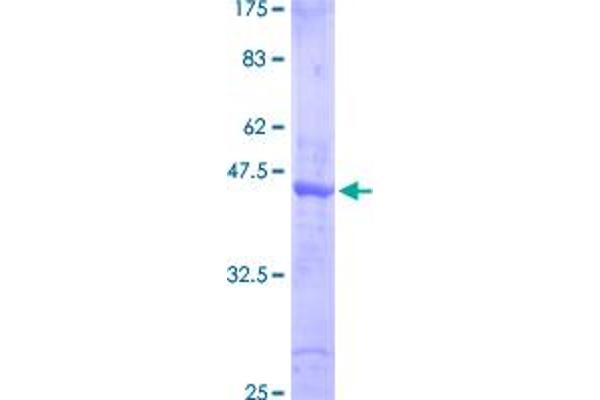 SMAD6 Protein (AA 285-384) (GST tag)