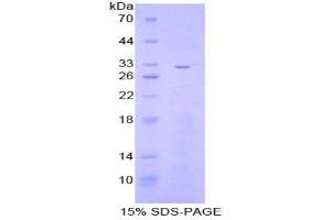 SDS-PAGE analysis of Mouse IkBz Protein. (Inhibitory Subunit of NF-KappaB zeta Protein)