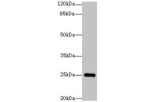 Western blot All lanes: GOSR2 antibody at 4 μg/mL + Jurkat whole cell lysate Secondary Goat polyclonal to rabbit IgG at 1/10000 dilution Predicted band size: 25, 23 kDa Observed band size: 25 kDa (GOSR2 antibody  (AA 1-190))