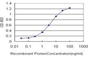 Detection limit for recombinant GST tagged GRK4 is approximately 0. (GRK4 antibody  (AA 36-145))