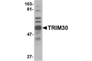 Image no. 1 for anti-Tripartite Motif Containing 30 (Trim30) (C-Term) antibody (ABIN342695) (TRIM30 antibody  (C-Term))