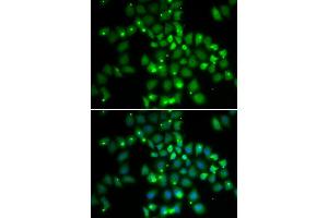 Immunofluorescence analysis of HeLa cells using PCGF6 antibody (ABIN5973382). (PCGF6 antibody)