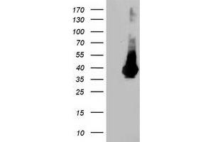 HEK293T cells were transfected with the pCMV6-ENTRY control (Left lane) or pCMV6-ENTRY LDLRAP1 (Right lane) cDNA for 48 hrs and lysed. (LDLRAP1 antibody)