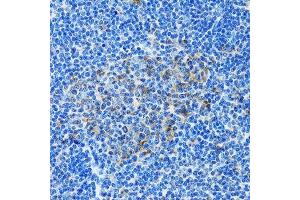 Immunohistochemistry of paraffin-embedded rat spleen using PAICS antibody. (PAICS antibody  (AA 176-425))