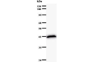 Western Blotting (WB) image for anti-Centromere Protein C 1 (CENPC1) antibody (ABIN932451) (CENPC1 antibody)