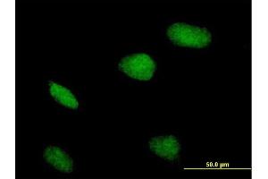 Immunofluorescence of purified MaxPab antibody to ZBTB32 on HeLa cell.