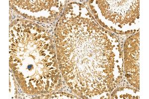 ABIN6262174 and ABIN6269018 at 1/100 staining Rat testis tissue by IHC-P. (HDAC10 antibody  (N-Term))