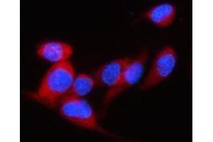 IF analysis of P97/DAP5/EIF4G2 using anti-P97/DAP5/EIF4G2 antibody (ABIN7600770).