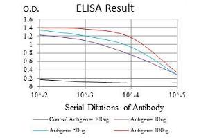 Black line: Control Antigen (100 ng), Purple line: Antigen(10 ng), Blue line: Antigen (50 ng), Red line: Antigen (100 ng), (MCM2 antibody)