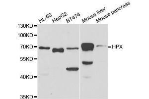 Western blot analysis of extracts of various cell lines, using HPX antibody. (Hemopexin antibody  (AA 24-245))