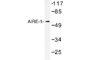 Image no. 1 for anti-Autoimmune Regulator (AIRE) antibody (ABIN272137) (AIRE antibody)