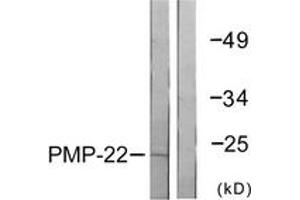 Western blot analysis of extracts from MDA-MB-435 cells, using PMP22 Antibody. (PMP22 antibody  (AA 111-160))