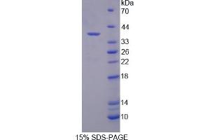 Image no. 1 for Syndecan Binding Protein (Syntenin) 2 (SDCBP2) (AA 1-292) protein (His tag) (ABIN4989750)