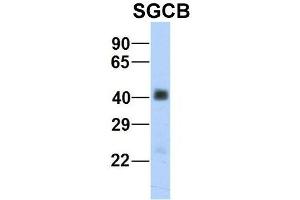 Host:  Rabbit  Target Name:  SGCB  Sample Type:  Human Fetal Heart  Antibody Dilution:  1. (SGCB antibody  (Middle Region))