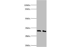 Western blot All lanes: Lymphocyte function-associated antigen 3 antibody at 2 μg/mL Lane 1: Hela whole cell lysate Lane 2: Jurkat whole cell lysate Secondary Goat polyclonal to rabbit IgG at 1/10000 dilution Predicted band size: 29, 27, 28 kDa Observed band size: 29 kDa (CD58 antibody  (AA 40-220))
