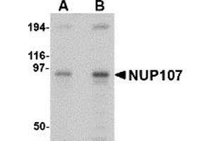 Western Blotting (WB) image for anti-Nucleoporin 107kDa (NUP107) (Middle Region) antibody (ABIN1031028) (NUP107 antibody  (Middle Region))