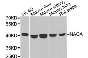 Western blot analysis of extracts of various cells, using NAGA antibody. (NAGA antibody)