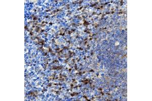 IHC analysis of NOXA2/p67phox/NCF2 using anti-NOXA2/p67phox/NCF2 antibody (ABIN7599462).