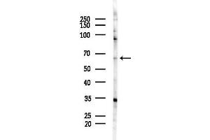 Western blot analysis of lysates from COLO205 cells(heat-shock,45 min treatment), using ACSM3 Antibody at 1/1000 dilution.