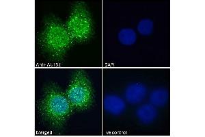 ABIN308459 Immunofluorescence analysis of paraformaldehyde fixed A431 cells, permeabilized with 0.