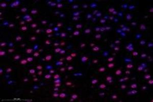Immunofluorescent analysis of paraformaldehyde-fixed mouse substantia nigra using,SUN2 (ABIN7075502) at dilution of 1: 1000