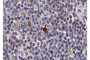 ABIN6267011 at 1/100 staining human Lymph node tissue sections by IHC-P.