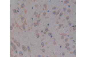 IHC-P analysis of Kidney tissue, with DAB staining. (PTK2B antibody  (AA 704-941))