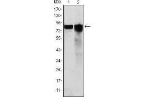 Glycogen Synthase 1 antibody