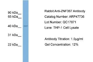 WB Suggested Anti-ZNF367  Antibody Titration: 0. (ZNF367 antibody  (C-Term))