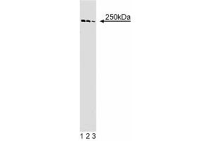 Western blot analysis of alpha-Spectrin II on Jurkat cell lysate. (SPTAN1 antibody  (AA 252-371))