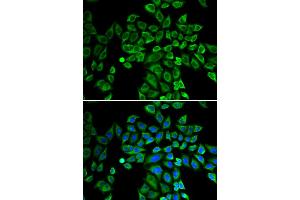 Immunofluorescence analysis of HeLa cells using ANGPT2 antibody. (Angiopoietin 2 antibody)