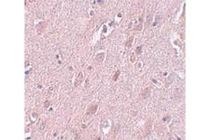 Immunohistochemical staining of human brain tissue with ZC3H12B polyclonal antibody  at 5 ug/mL dilution. (ZC3H12B antibody  (N-Term))