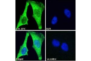 ABIN1590087 Immunofluorescence analysis of paraformaldehyde fixed HeLa cells, permeabilized with 0. (ATF6 antibody  (AA 437-449))