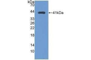 Detection of Recombinant TFR2, Human using Monoclonal Antibody to Transferrin Receptor 2 (TFR2) (Transferrin Receptor 2 antibody  (AA 4-87))