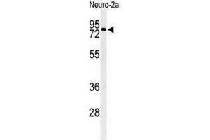 Western blot analysis of CIRH1A Antibody (N-term) in Neuro-2a cell line lysates (35µg/lane).