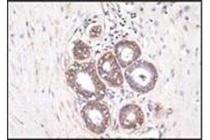 Immunohistochemistry (IHC) image for anti-S-100 (C-Term) antibody (ABIN870446) (S-100 antibody  (C-Term))