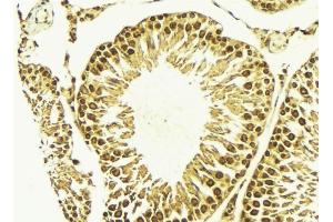 ABIN6269047 at 1/100 staining Mouse testis tissue by IHC-P. (IKBKB antibody)