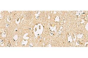 LRRC28 antibody
